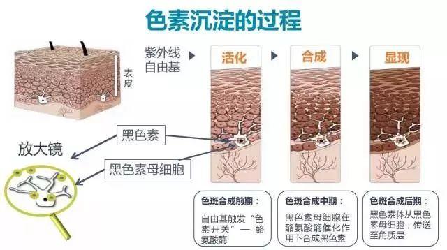 脸上长斑如何解决，Nuskin如新还肌肤一份“清白”