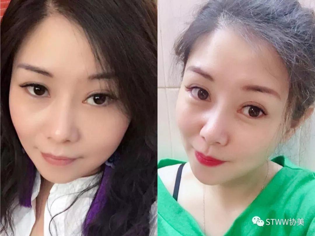 【每日一星】我们不一样，你想回到18岁吗？--蔡绵