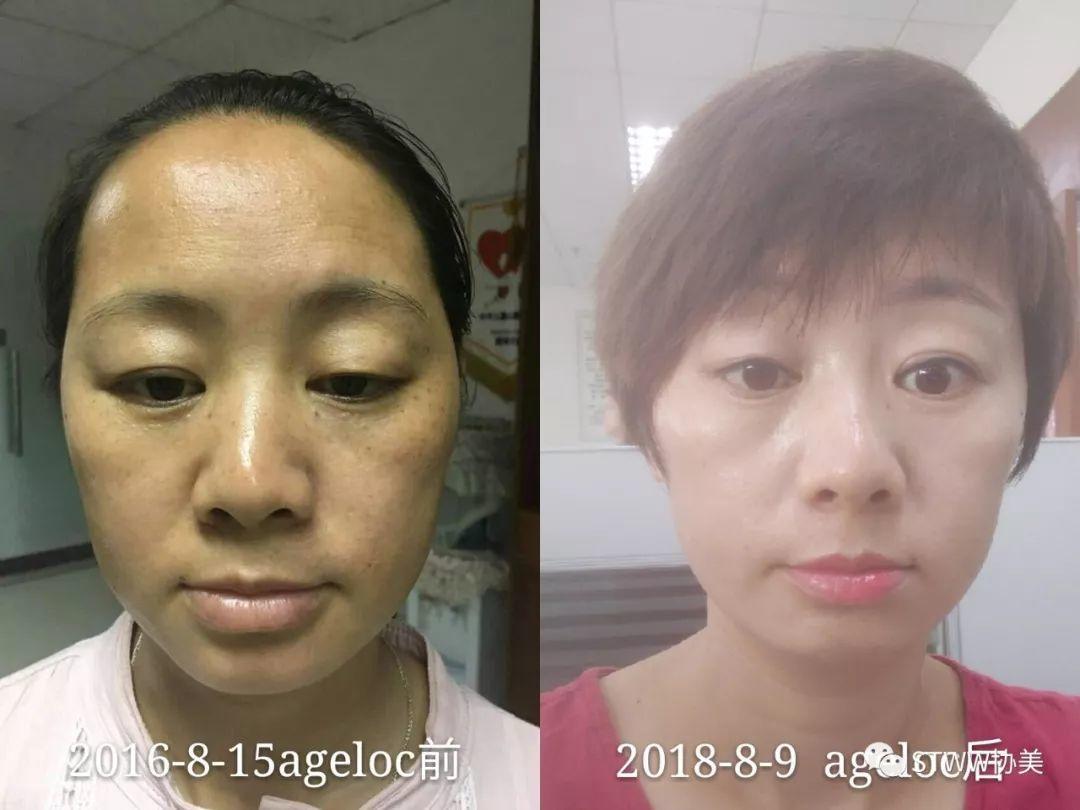 【每日一星】ageLOC让我们夫妻遇见更好的自己--黄真金