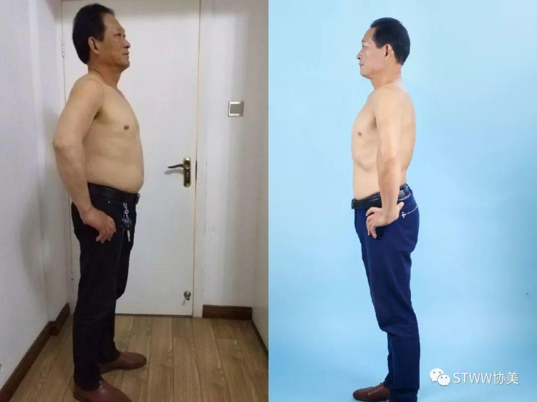 【每日一星】ageLOC让夫妻重回型男靓女--胡素红