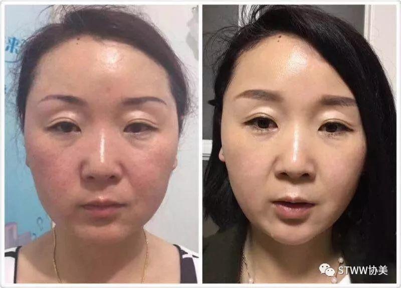 【每日一星】锅台主妇变辣妈--李红梅