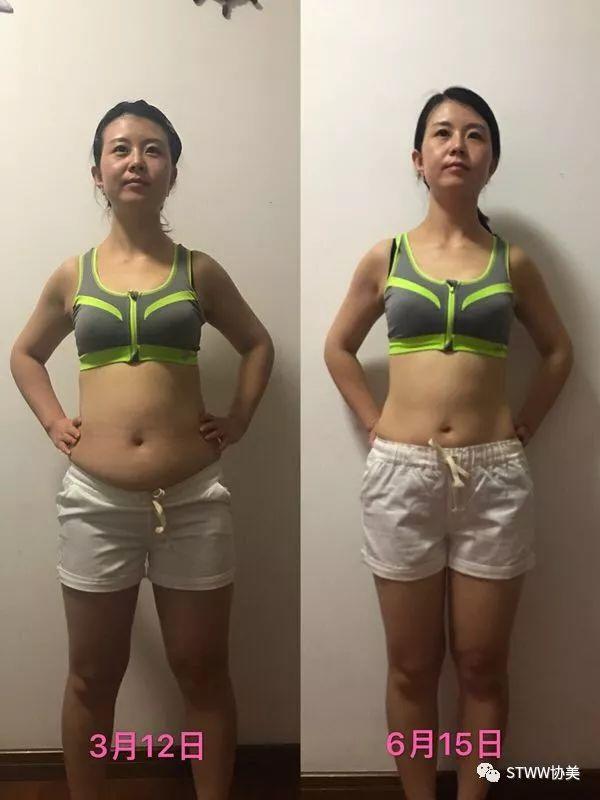 【每日一星】整形医院工作者的抗衰故事--李诗萱