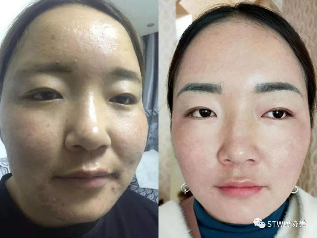 【每日一星】高原重新绽放的花朵--赛尔吉玛