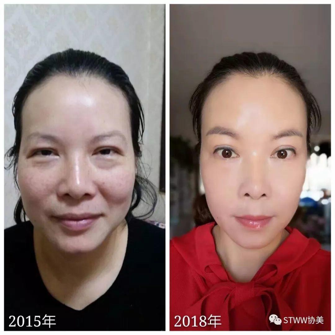 【每日一星】生命不息，逆袭不止，只为遇见曾经的我--文倩
