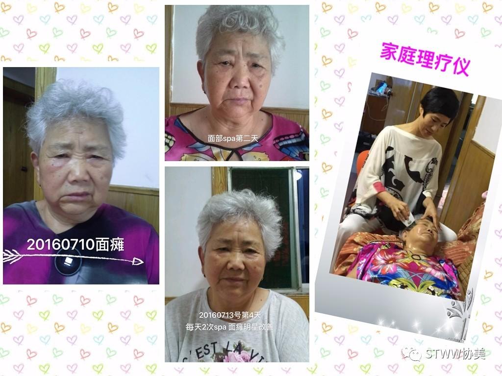 【每日一星】83岁老妈的养生之道--徐玉荣