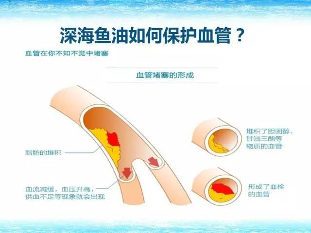 关于鱼油你不得不知的秘密