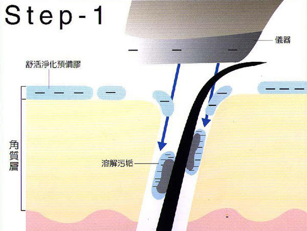 你所不了解的Spa机（知识篇）