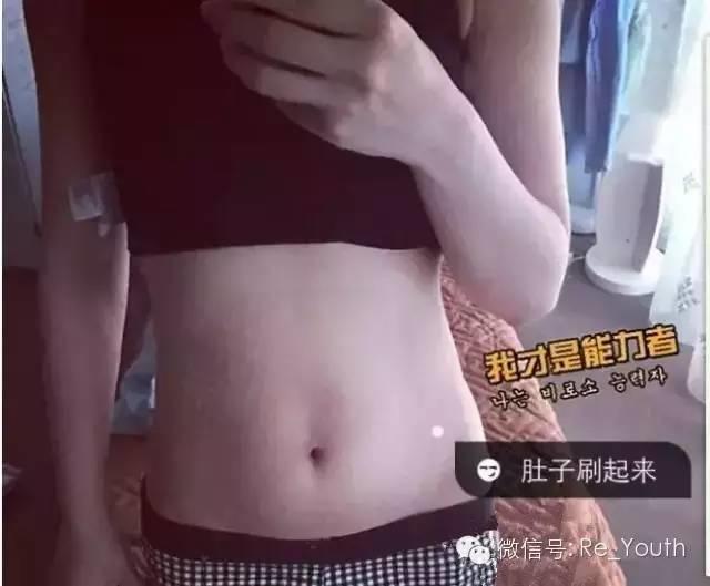 BODY Spa机如何轻松去掉妊娠纹