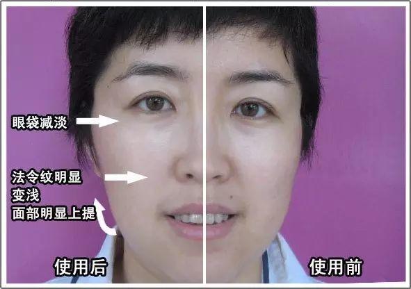 NU SKIN ageLOC spa机超多见证，以后再也不要问我是不是P的图啦！