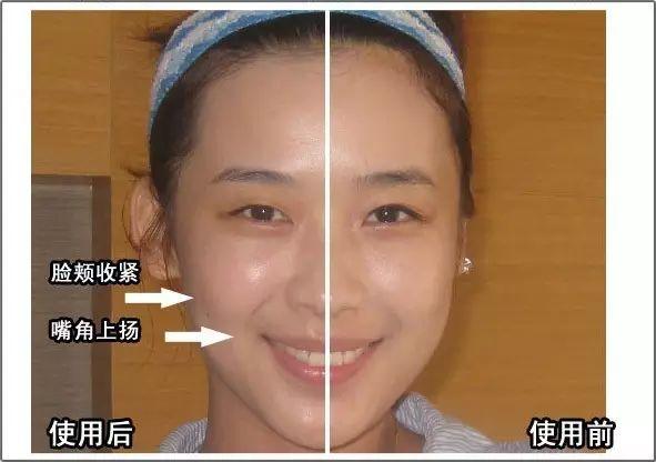 NU SKIN ageLOC spa机超多见证，以后再也不要问我是不是P的图啦！