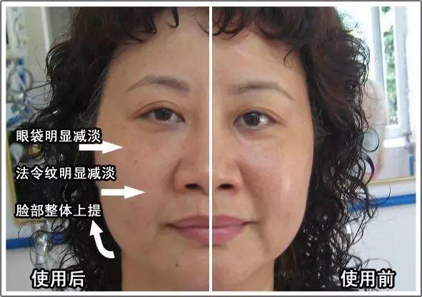 NU SKIN ageLOC spa机超多见证，以后再也不要问我是不是P的图啦！