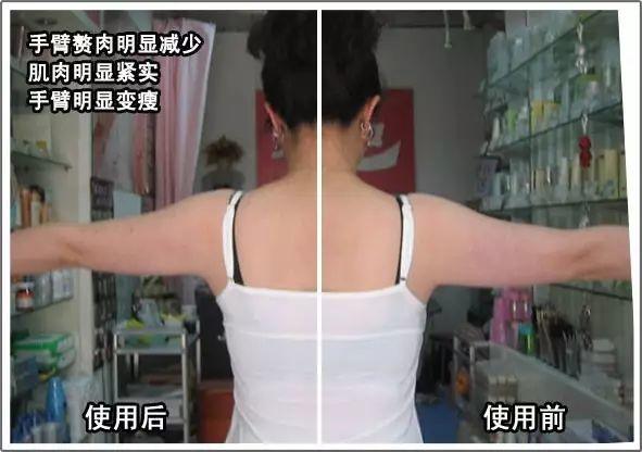 NU SKIN ageLOC spa机超多见证，以后再也不要问我是不是P的图啦！