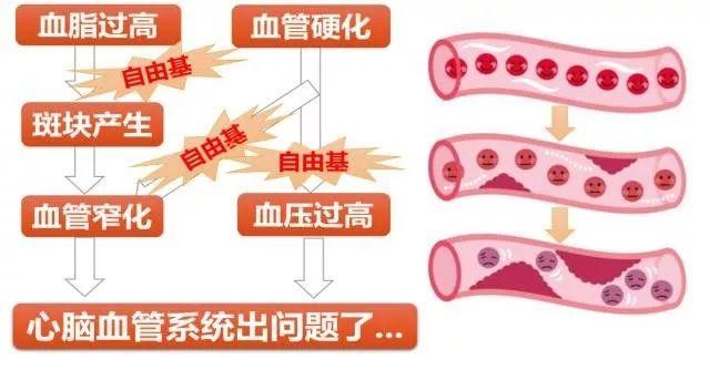 保健食品专家谈心血管保护——未雨绸缪更重要