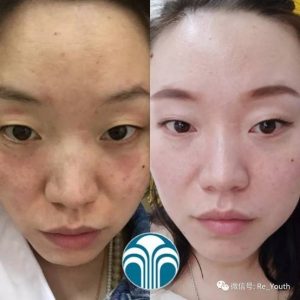 【每日一星】一瓶补水喷雾引发的故事–魏雯