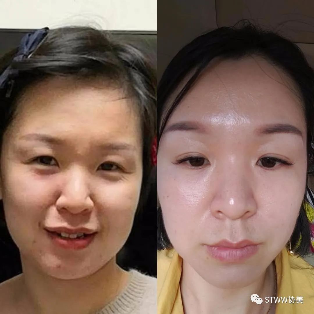 【每日一星】重新找回曾经美丽的自己--康培