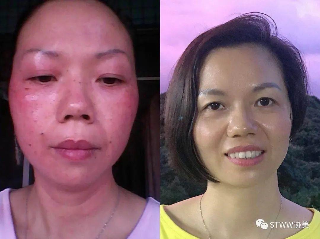 【每日一星】【每日一星】我的皮肤就是各种品牌的实验田–郑秀琼