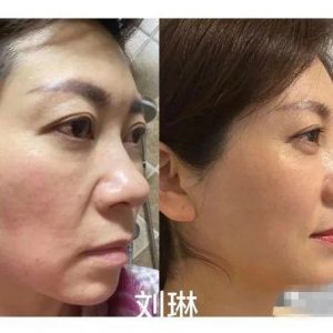 【每日一星】服装店老板的抗衰故事