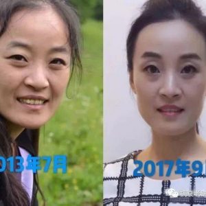【每日一星】NUSKIN开启骨科医生的魅力人生