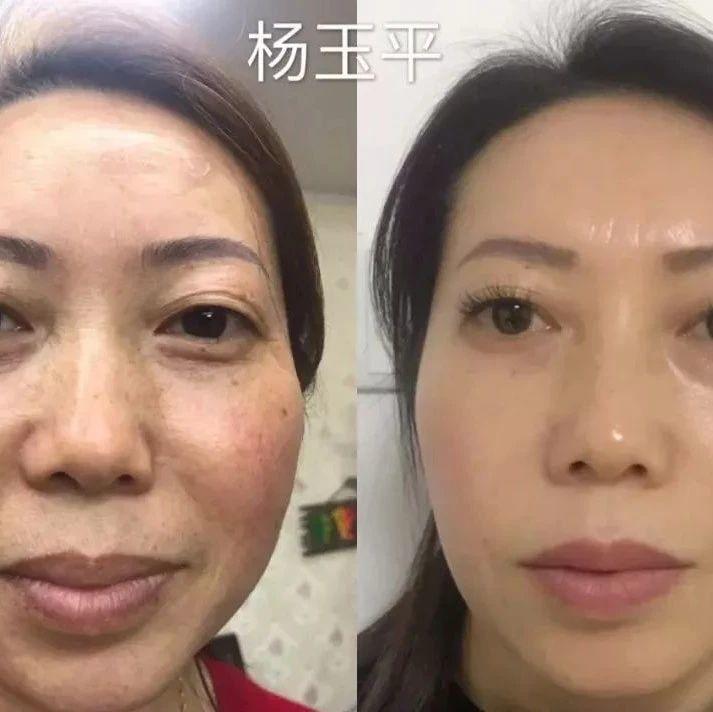 【每日一星】如新让我找回健康，美丽和自信