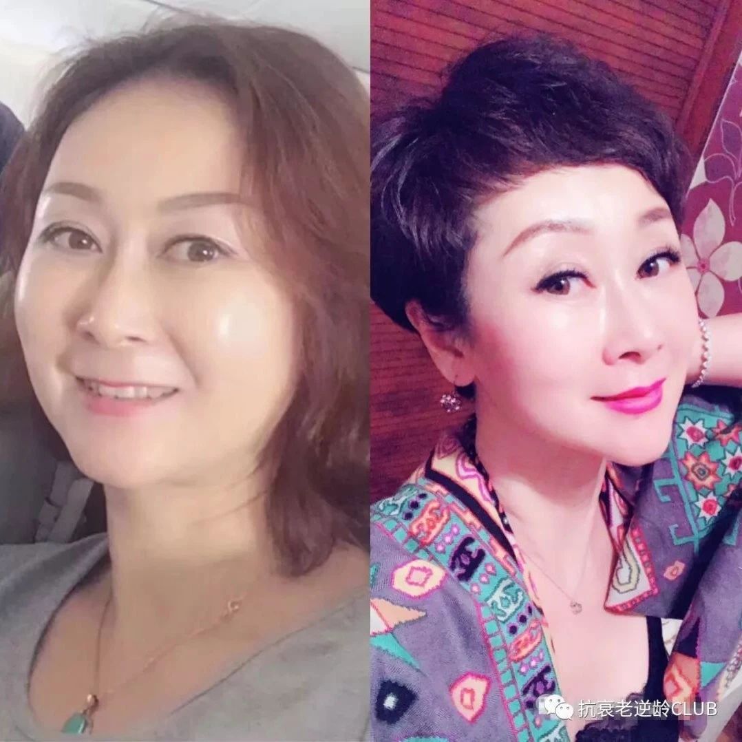 【逆龄】永远年轻不是梦